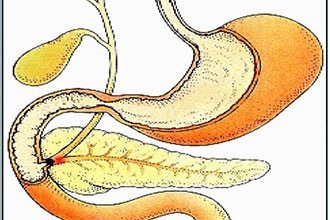 informat_1551321563981
